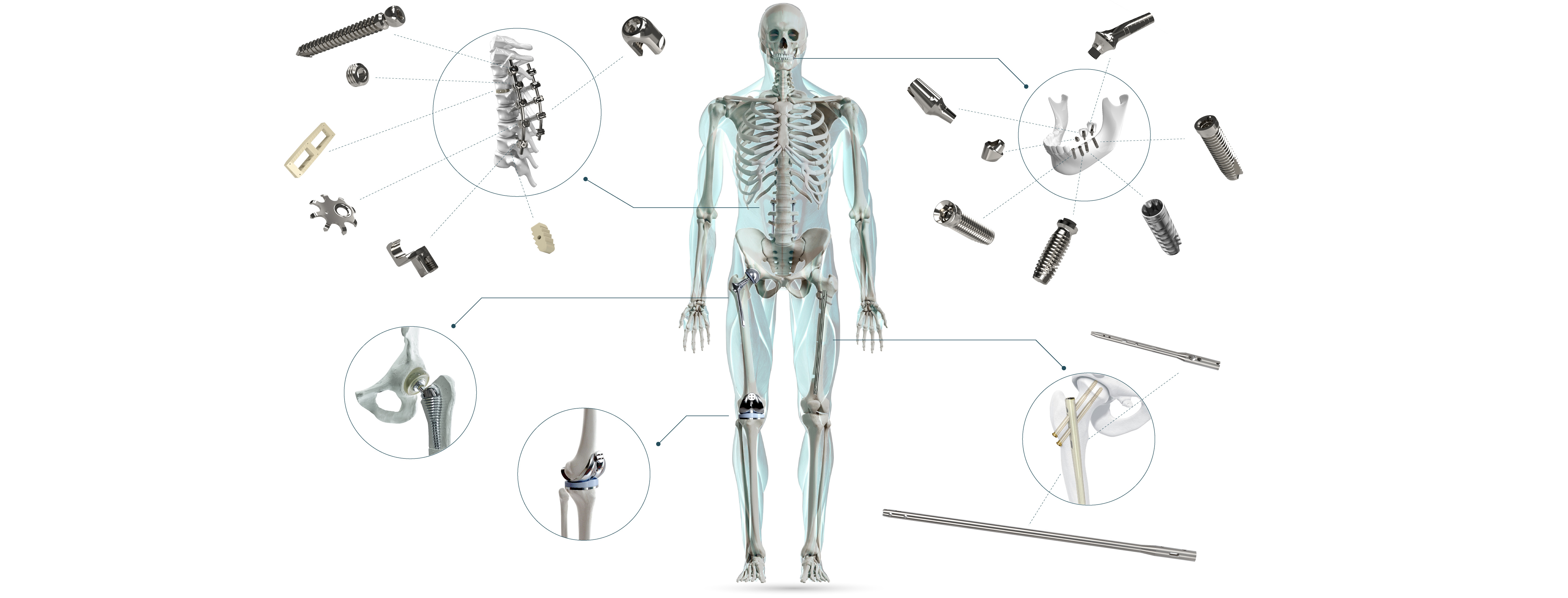 Skeleton View
